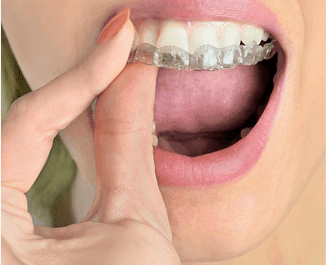 Protetică Dentară